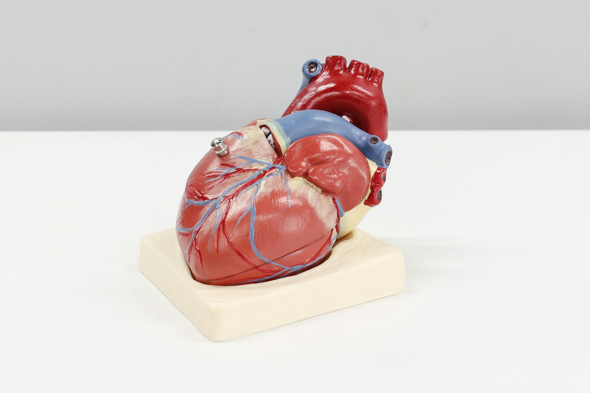 Anatomical model of a human heart